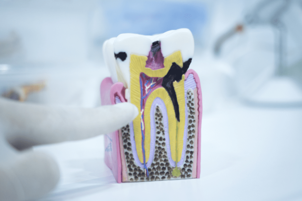The 6 Signs of Tooth Decay You Shouldn’t Ignore