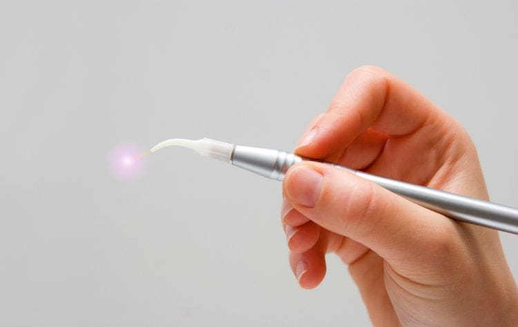 Laser Dentistry in Center Valley, PA